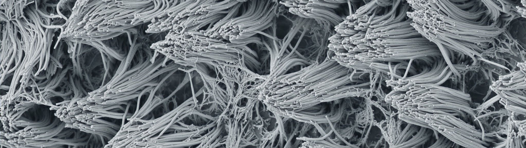 Scanning electron micrograph of airway cilia