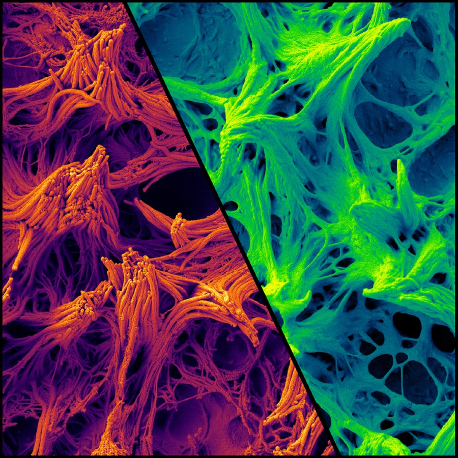 Scanning electron micrographs of airway cilia