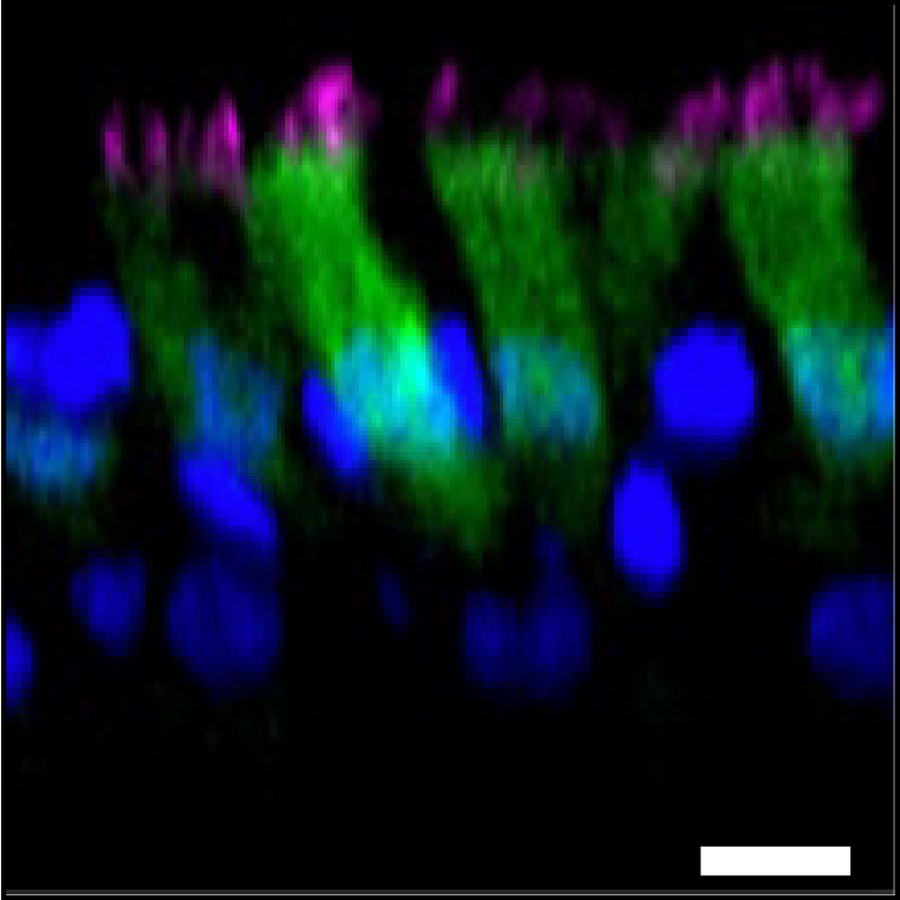 Immunofluorescence of airway epithelium