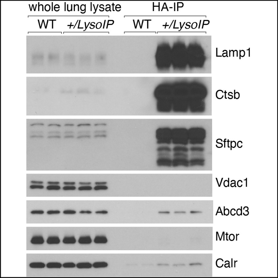 Immunoblots of lung lysosome immunoprecipitation